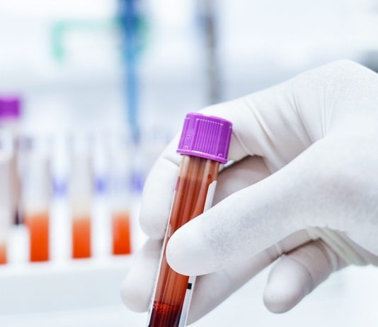 Nova Venécia recebe certificado de Excelência em seus procedimentos laboratoriais