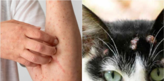 Esporotricose: Prefeitura de Nova Venécia emite alerta sobre doença que afeta humanos e gatos