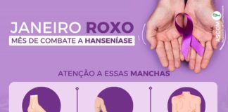Secretaria de Saúde promove companha de conscientização e combate a Hanseníase