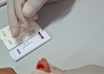 Nova Venécia realizará “Dia D” de testagem e prevenção ao HIV/AIDS e demais ISTs
